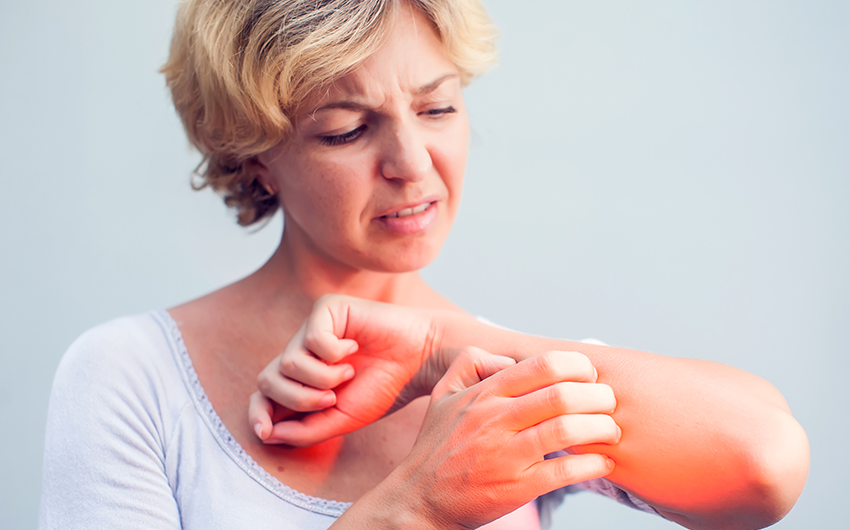 A woman with prurigo nodularis digs intensely with her fingernails on her arm where she has itchy bumps.