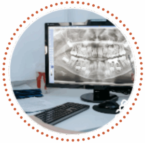 A computer monitor shows a generic x-ray image.