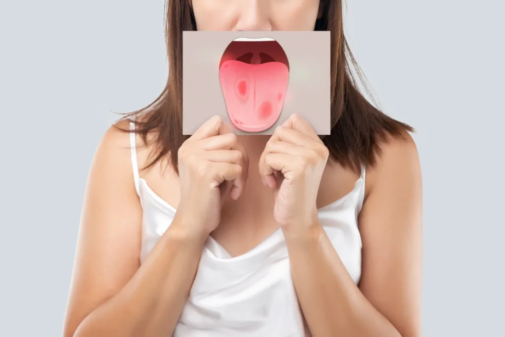 Sjogren’s Disease Research Study